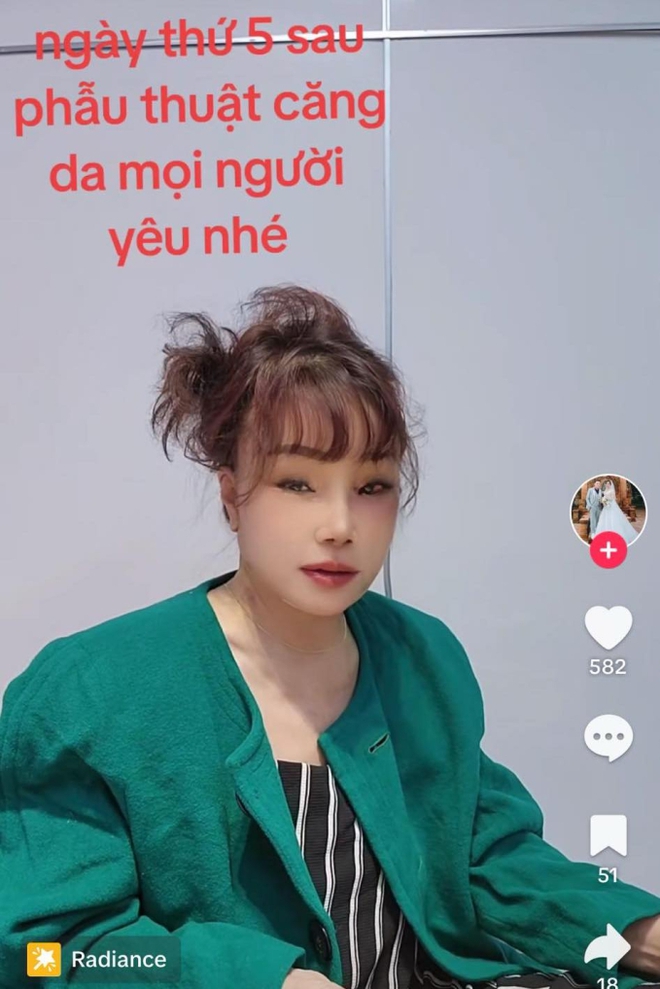 Cô dâu 62 tuổi Thu Sao lộ ngoại hình khác lạ sau khi phẫu thuật căng da mặt níu giữ tuổi xuân, tiết lộ thái độ của chồng trẻ - Ảnh 3.