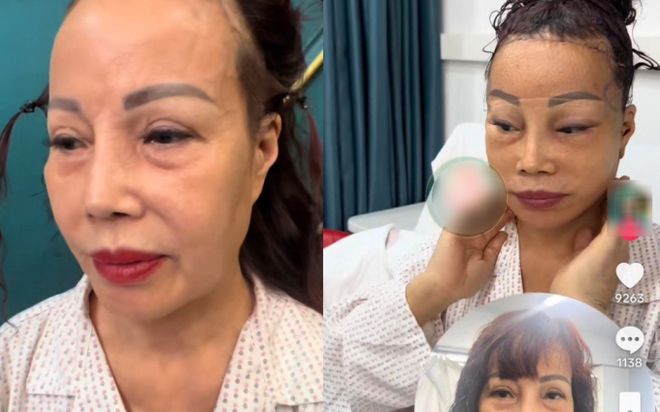 Cô dâu 62 tuổi Thu Sao lộ ngoại hình khác lạ sau khi phẫu thuật căng da mặt níu giữ tuổi xuân, tiết lộ thái độ của chồng trẻ - Ảnh 2.