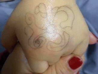 Con gái mừng rỡ khi được "giáo viên" vẽ ký hiệu lạ trên tay, nhưng vừa nhìn thấy bà mẹ lập tức báo cảnh sát- Ảnh 1.